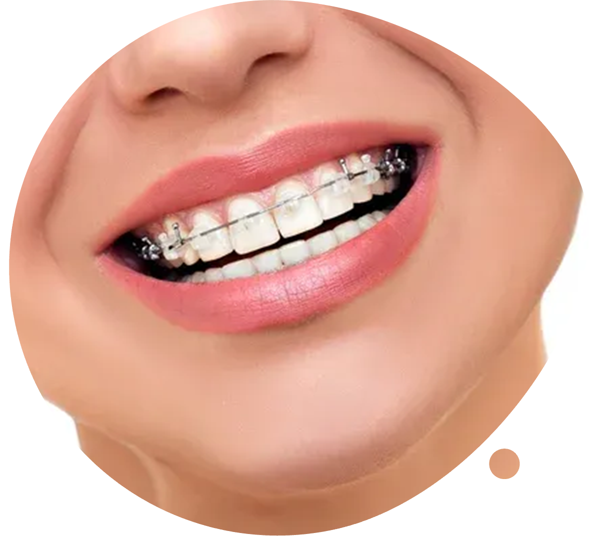 wp-content/uploads/sites/18/2020/01/Orthodontics.png
